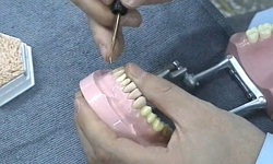 치아형태 실습2